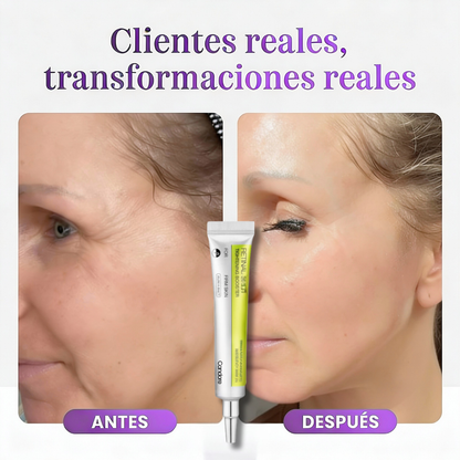 Candore® Serum Anti Envejecimiento